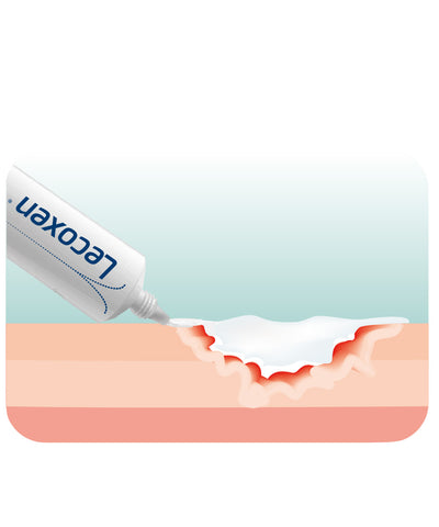 Lecoxen® Cremă pentru plagi cronice si arsuri