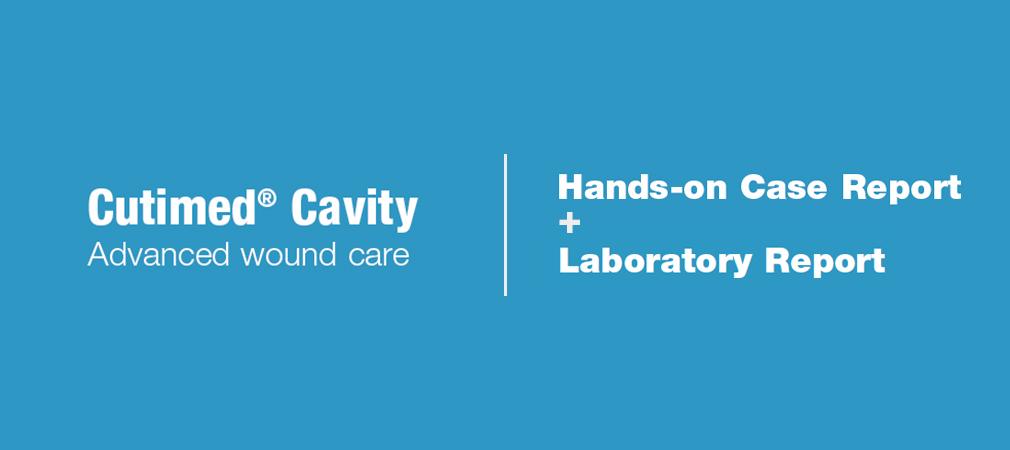 Cutimed Cavity - doctorplaga.ro