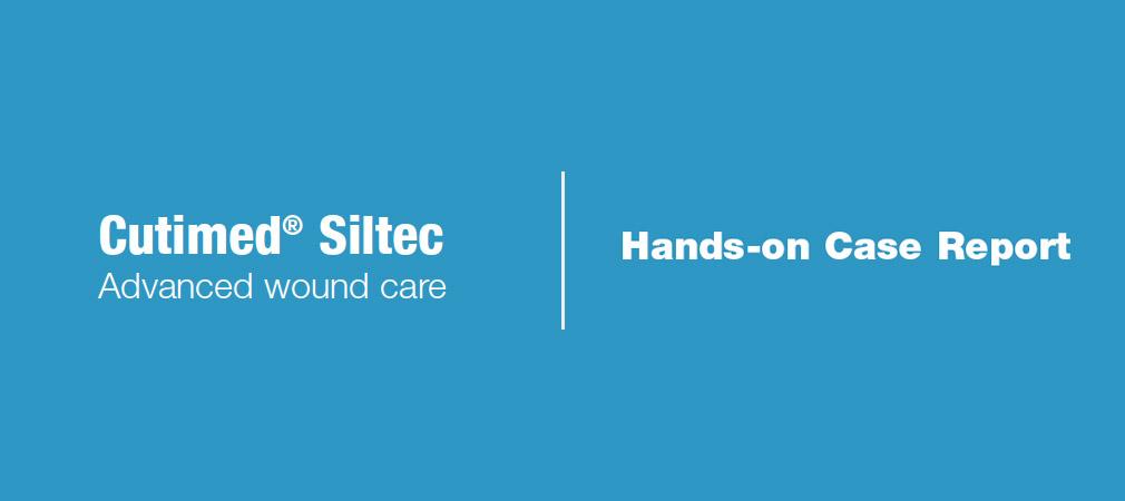 Cutimed Siltec - doctorplaga.ro