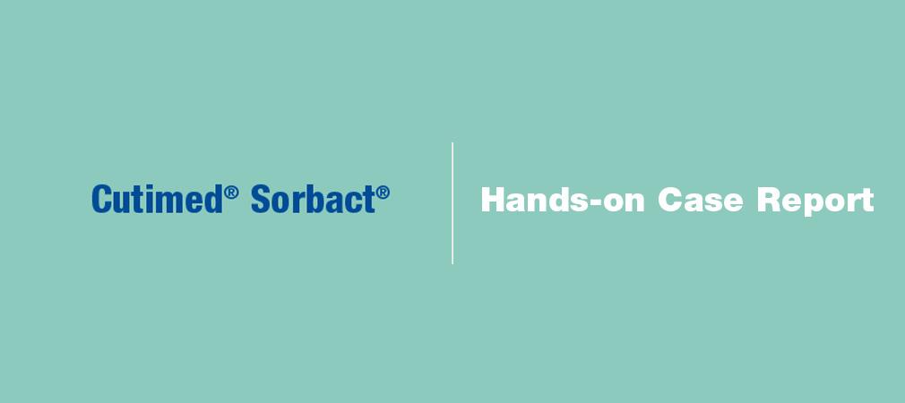 Cutimed sorbact - doctorplaga.ro