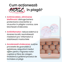 Microdacyn® Hydrogel, gel amorf hidroactiv, pe bază de acid hipocloros
