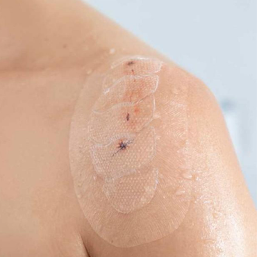 Leukomed® Control, pansament steril transparent