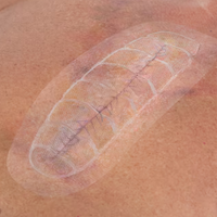 Leukomed® Control, pansament steril transparent