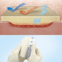 Cutimed® Hydro L, pansament cu strat de hidrocoloid, 1 buc.